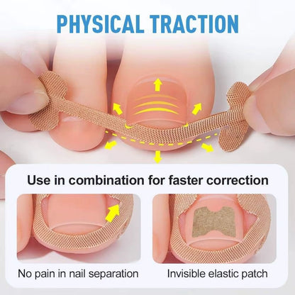 Professional Ingrown Toenail Correction Kit