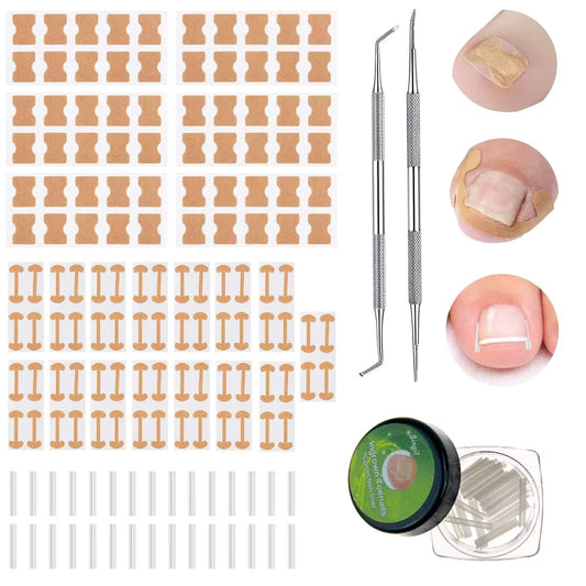 Professional Ingrown Toenail Correction Kit