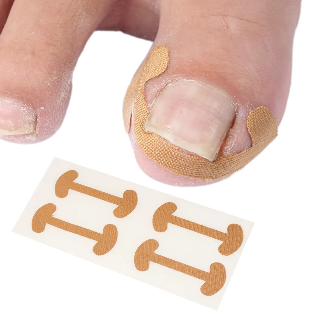 Nail patch applied to a fingernail with additional patches on a white background